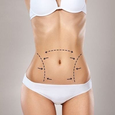 360 Liposuction