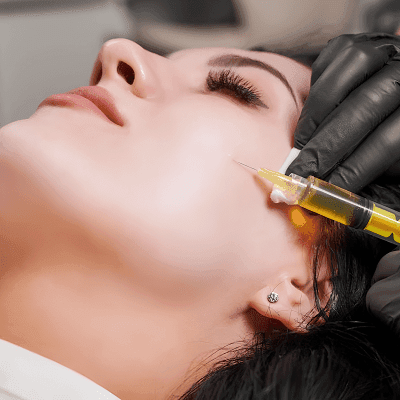 Are Vampire Facials Effective for Dark Circles?