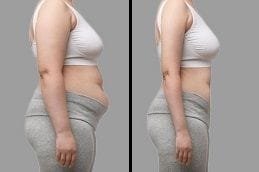 Wegovy in Dubai 5 Before & After Wegovy