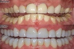 Best Cosmetic Dentist in Dubai Abu Dhabi