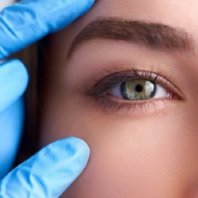 Eyelid Surgery or Blepharoplasty in Dubai