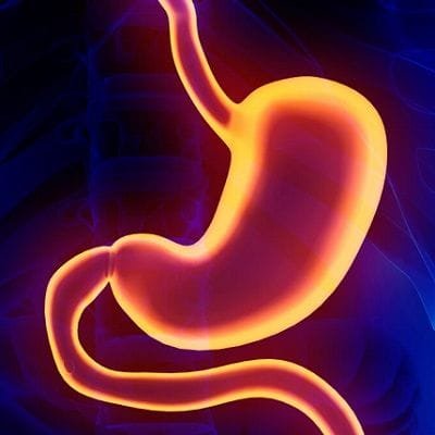 Gastric Plication in Dubai