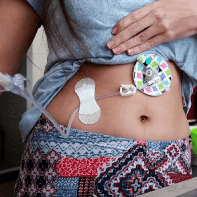 Best Home Enteral Nutrition Options In Dubai