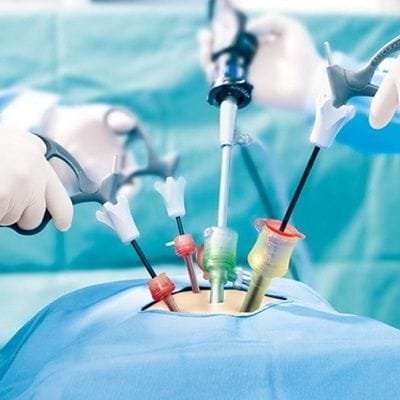Laparoscopic Surgery in Dubai