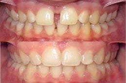 Best Orthodontic Clinic in Dubai and Abu Dhabi