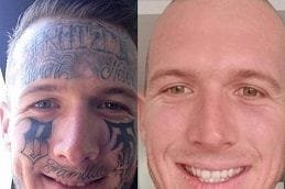 Best eyebrow-tattoo-removal in dubai