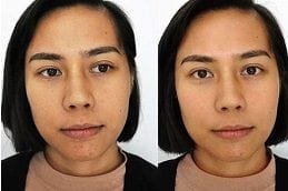 Best gluta-drip-in-dubai in dubai