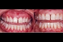 Best laser-gum-surgery Clinic in Dubai