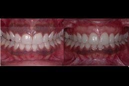 Laser Gum Surgery 6 Best laser-gum-surgery in Abu Dhabi