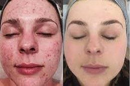 Skin Diseases 6 Best skin-diseases Clinic in Dubai