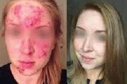 Skin Diseases 4 skin-diseases in Abu Dhabi