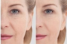 skincare-treatments Clinic in Dubai