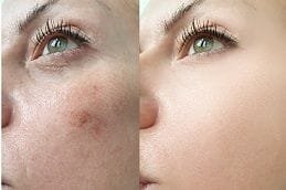 Best-skincare-treatments-in-dubai