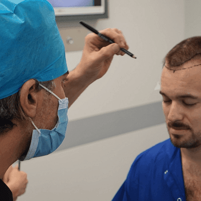 Biofibre Hair Transplant