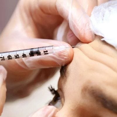 Botox Injections for Migraine Headache