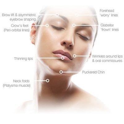 Botulinum Toxin injections in Dubai