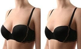 Breast Surgery Clinic Dubai-Dynamic Clinic