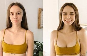 Breast Surgery Clinic in Dubai & Abu Dhabi