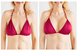 Breast Surgery Clinic in Dubai