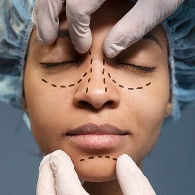 Breathe Easy and Look Great with Rhinoplasty