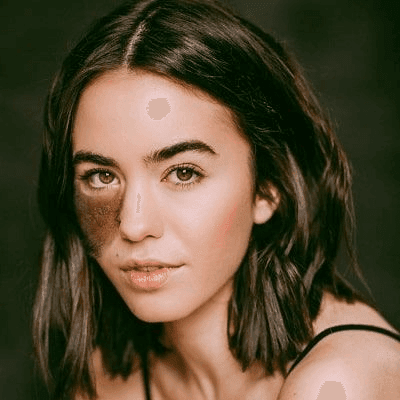 Can Birthmarks on The Face be Removed?