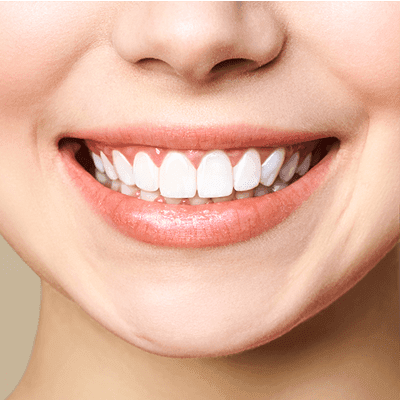 Can Yellow Teeth be Whiten Again?