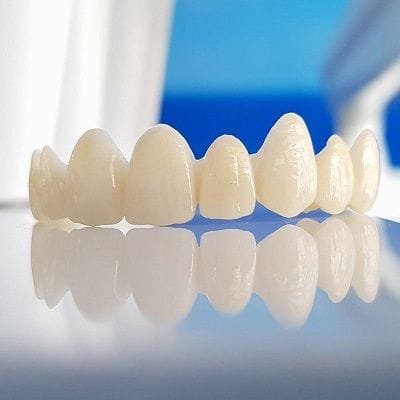 Ceramic Crowns in Dubai; A Painless Path to Picture-Perfect Teeth