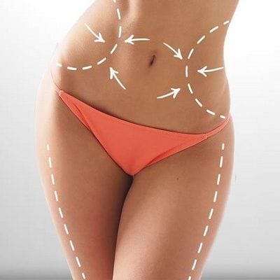 Cheapest Waist Sculpting in Dubai UAE & Abu Dhabi | Waist Sculpting Cost