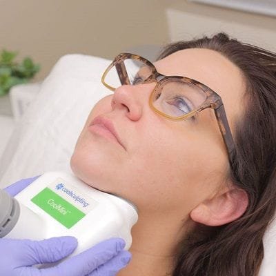 Coolsculpting for face in Dubai