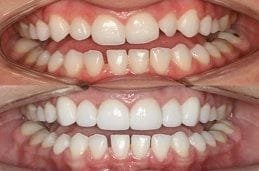 Cosmetic Dentistry Dubai