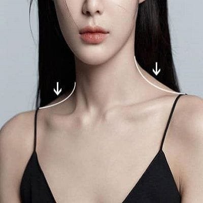 Cost of Shoulder Botox in Dubai