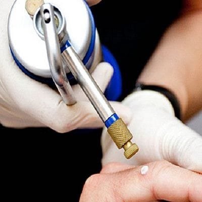 Cryosurgery in Dubai