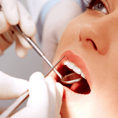 Dental Tooth Filling in Dubai