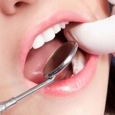 Dentist extraction in dubai