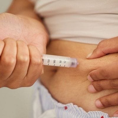 Do People Lose Weight on 2.5 mg Zepbound?