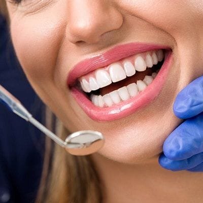 E-Max Veneers in Dubai & Abu Dhabi UAE Veneers Price & Cost