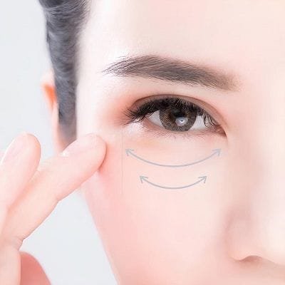 Eye Bag Removal in Dubai