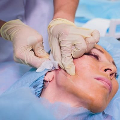 Face Lift With Threads in Dubai - Thread Lift Price UAE