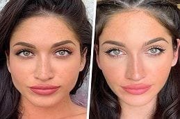 Facial Slimming Treatment