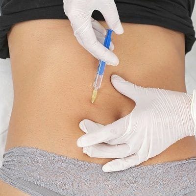 Gastric Botox Injection for Weight Loss