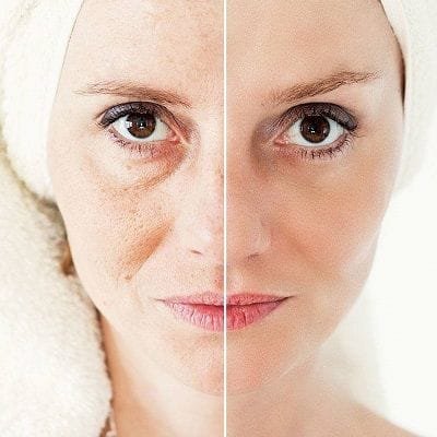 Get Younger by Skin Tightening and Contouring Treatment in Dubai