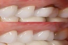 Gum disease treatment dubai