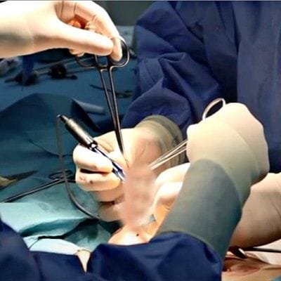 Unveiling the Truth: The Science Behind Male Circumcision