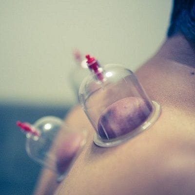 Hijama For Asthma In Dubai & Abu Dhabi