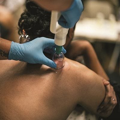 Hijama For Cholesterol In Dubai & abu dhabii