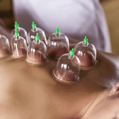 Hijama Therapy Cost In Dubai