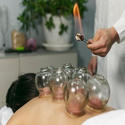 Hijama Wet Cupping Therapy