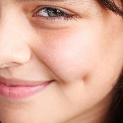 How Long Do Surgical Dimples Last?