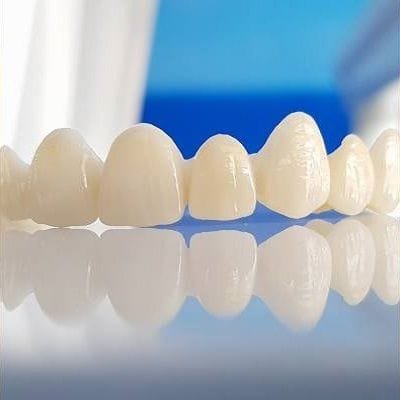 How Long Do Zirconia Crowns Last in Dubai