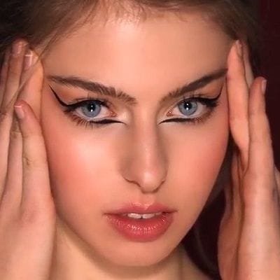 How Much Does Eye Bag Removal Cost Dubai & Abu Dhabi
